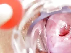 La enfermera cochina se queda yon solas